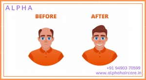 Alpha - Hair Transplant, Cosmetology & Slimming Clinic -